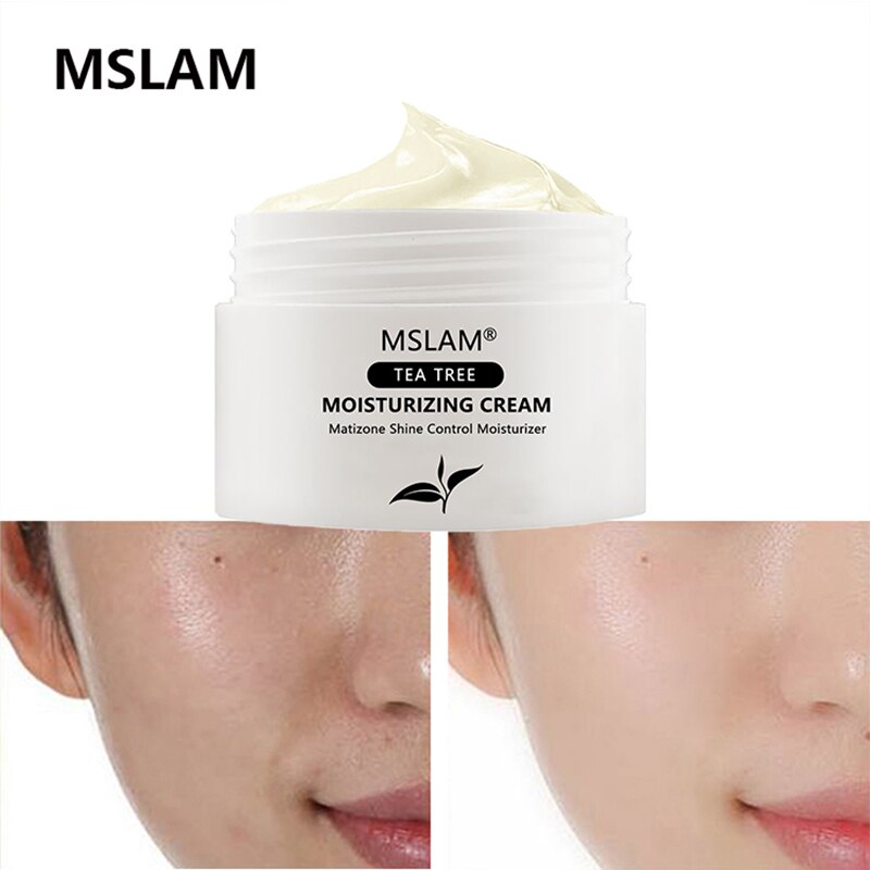 MSLAM Tea Tree Face Cream Deep Hydration Balanced Oil Facial Care Nourishing And Moist Facial Cream 30ml
